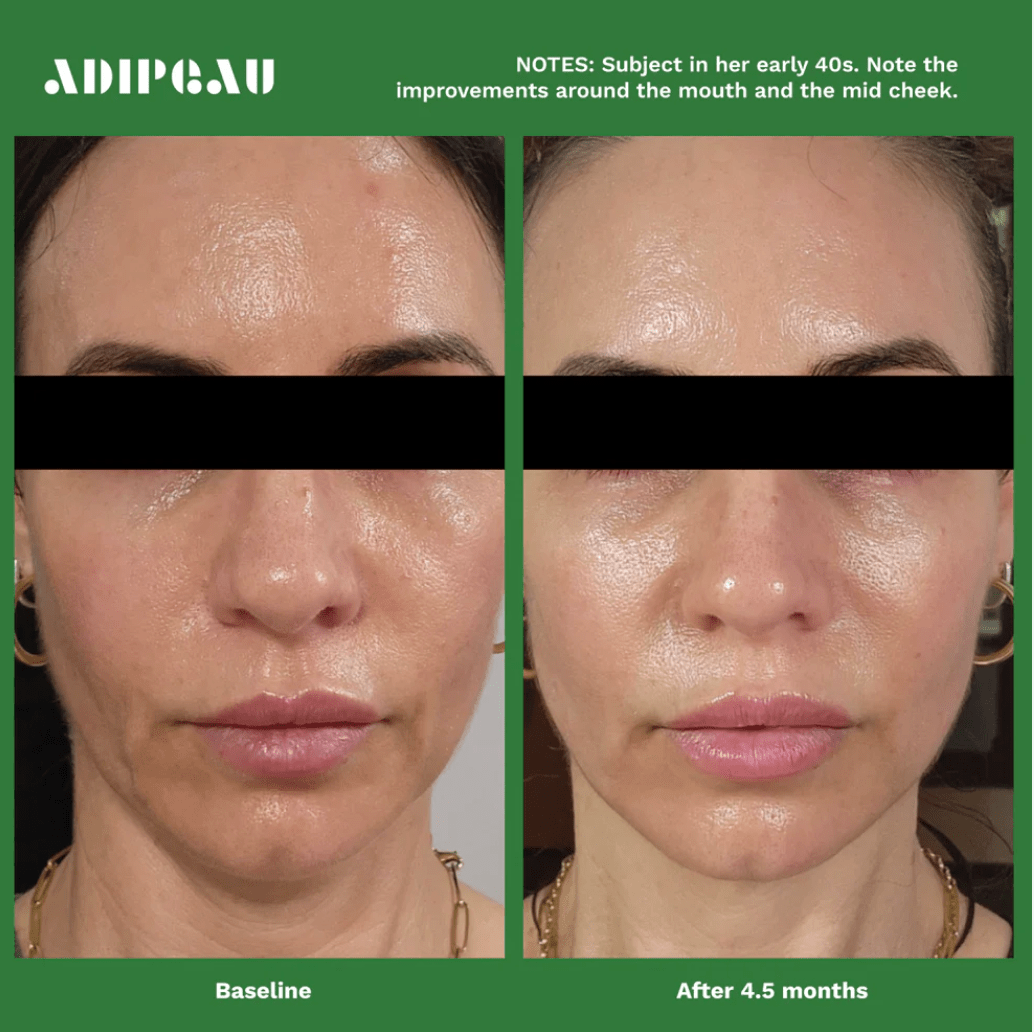 Living Beauty face cream Adipeau Volume Cream