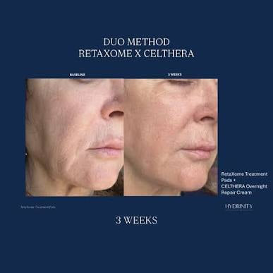 Hydrinity Skincare CÉLTHERA Advanced Overnight Repair Cream